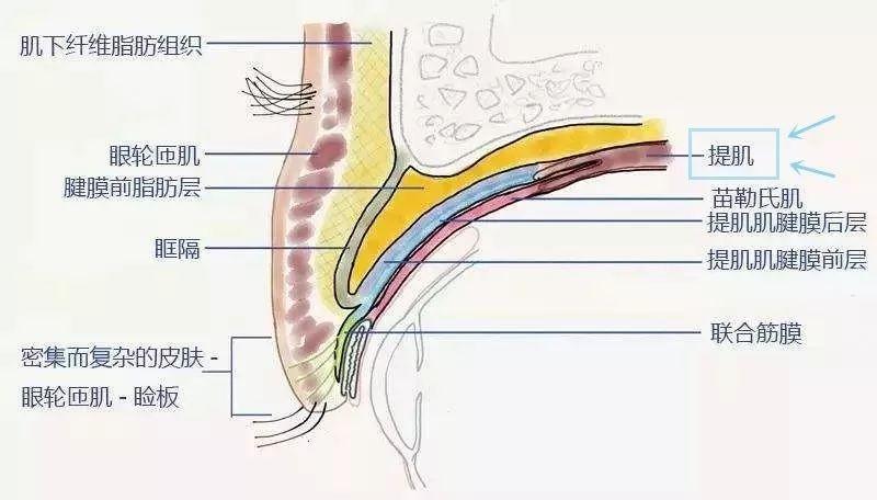 这类眼睛不做提肌，双眼皮也等于白做！